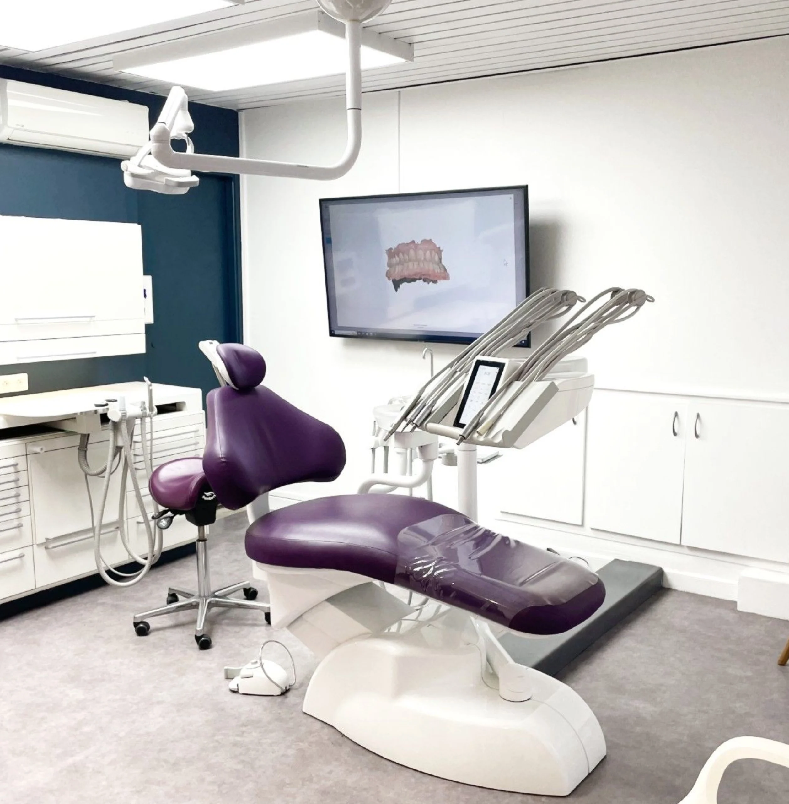 soins gencives implants scaled